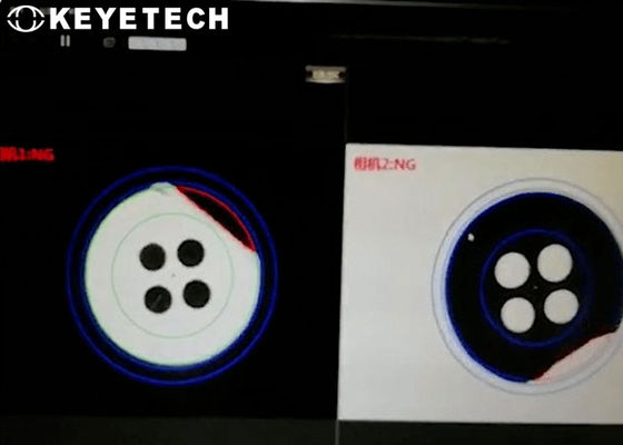 Automated Vision Inspection Machine for Garment Clothes Buttons Checking